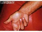 Loverboy LP